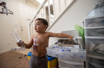 Young boy with medical equipment in living room.